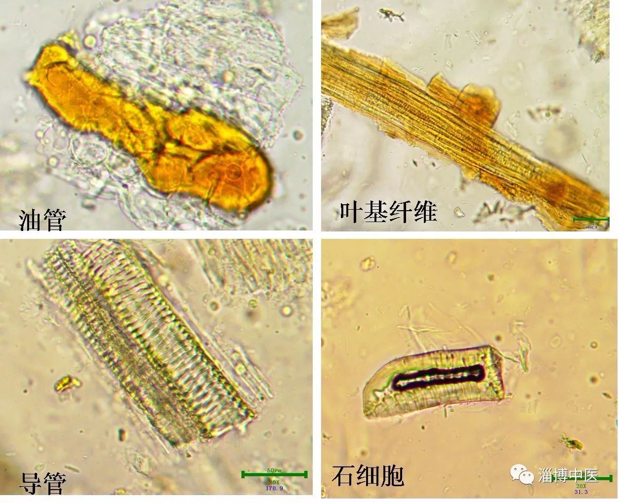 黄豆芽的导管显微图图片