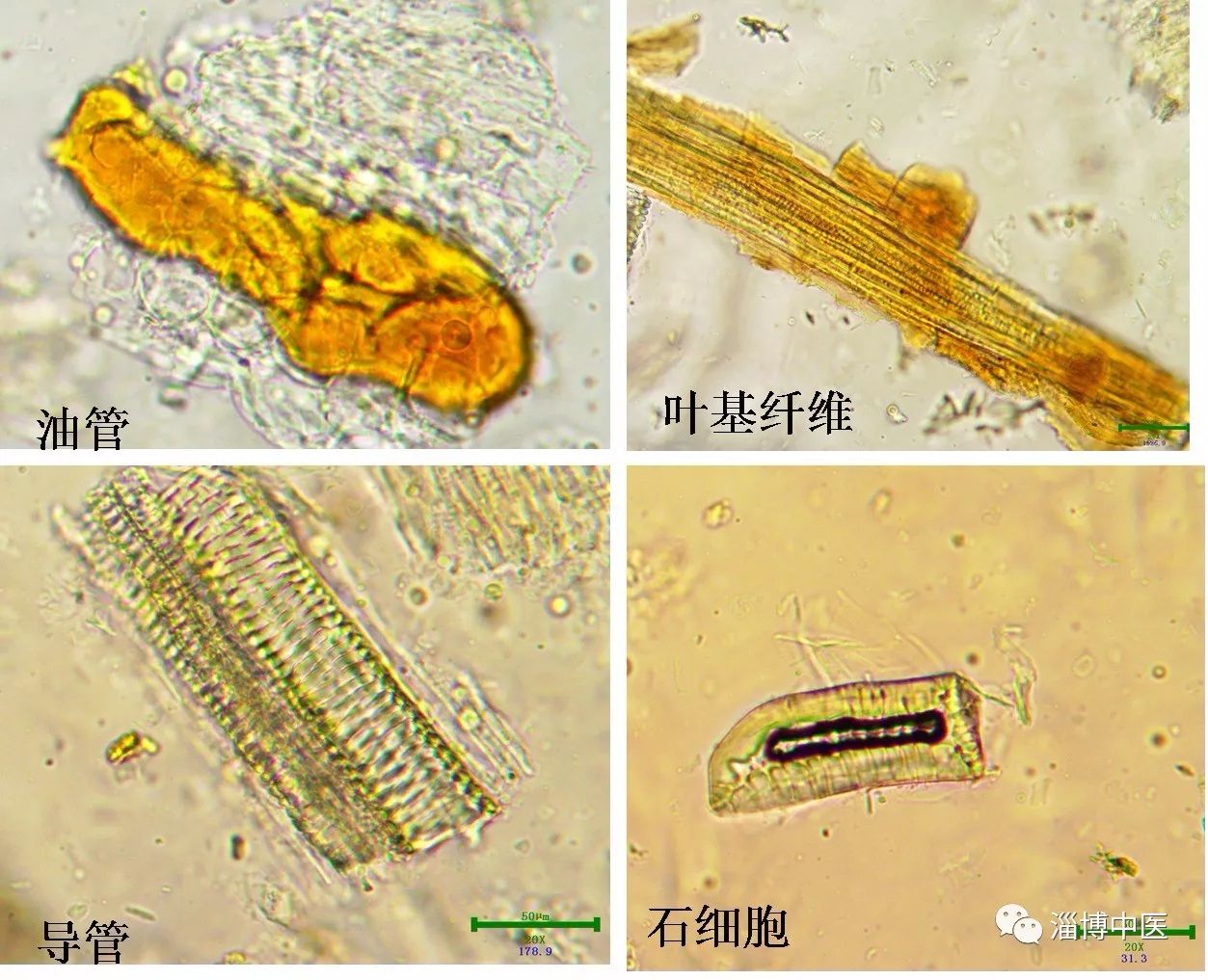 导管显微鉴别图图片