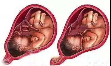 37周胎儿图片