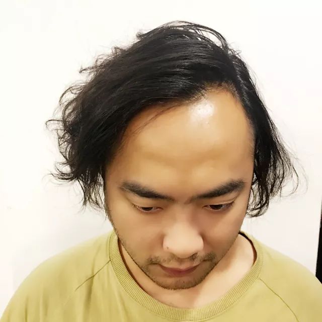 何况还是母胎遗传都能对抗高不可攀的发际线毕竟不是所有的barber我