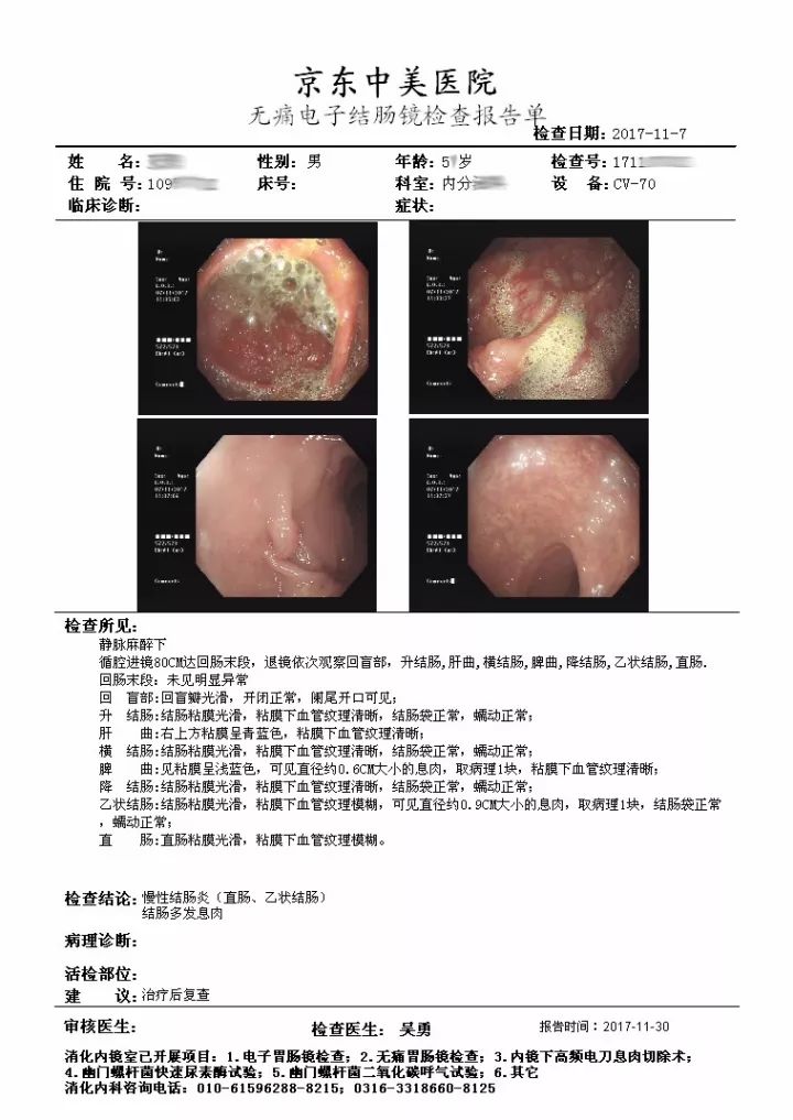 肠息肉活检报告图片