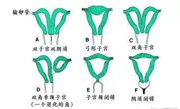 子宫颈外翻图片