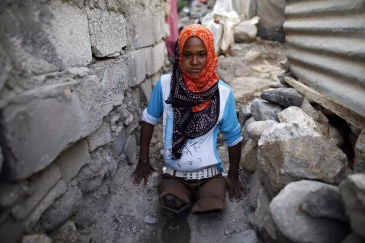 这位失去双腿的也门女性,生活非常难熬