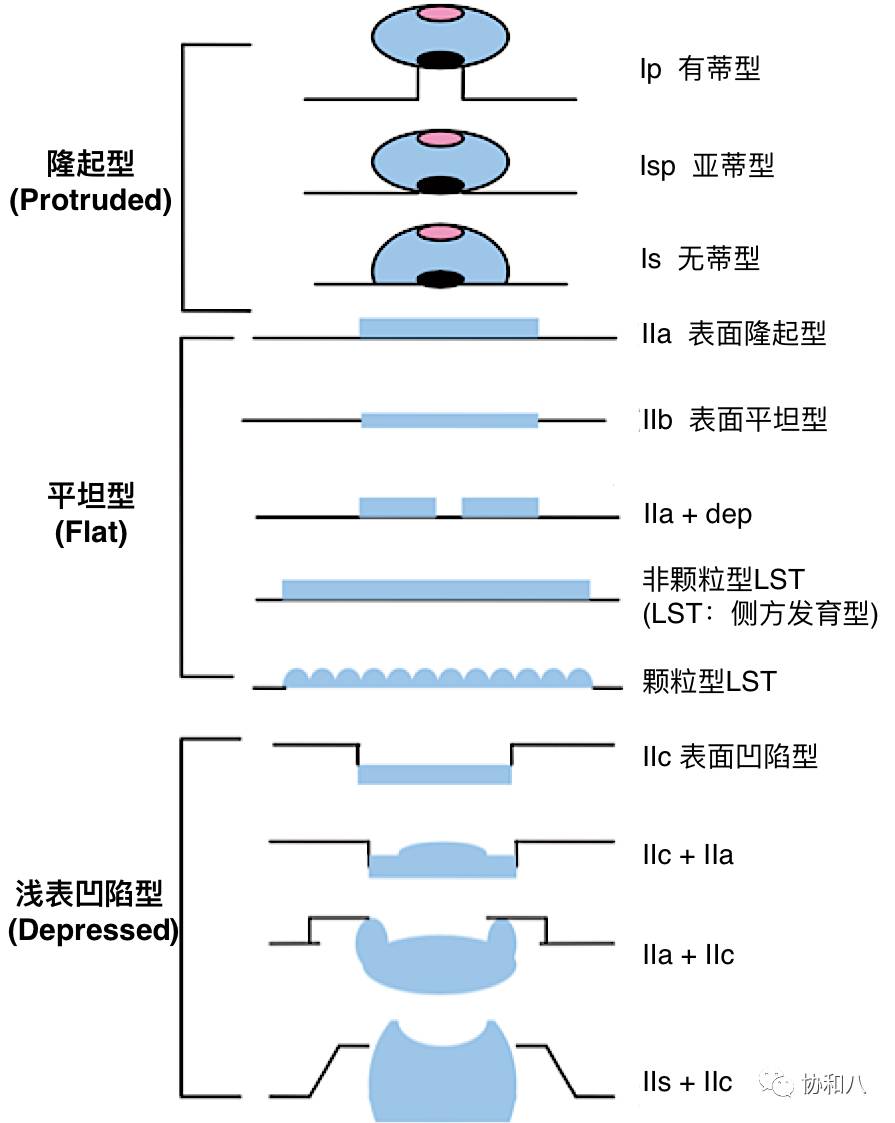 山田息肉图片