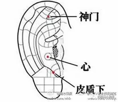 皮质下定位图片图片