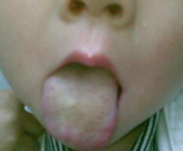 宝宝舌苔厚白是怎么回事?教你从舌苔中判断宝宝的健康情况!