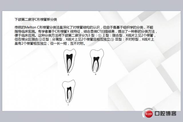 c形根管形态图片