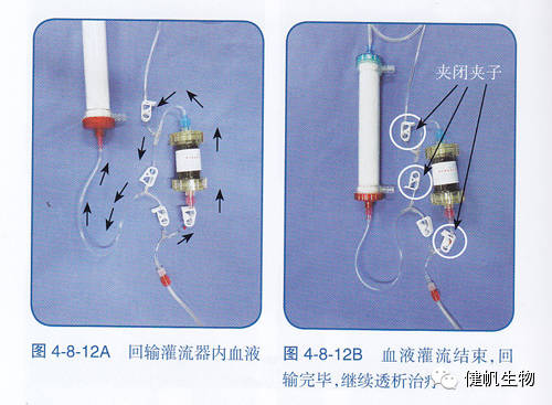 血液灌流安装图图片