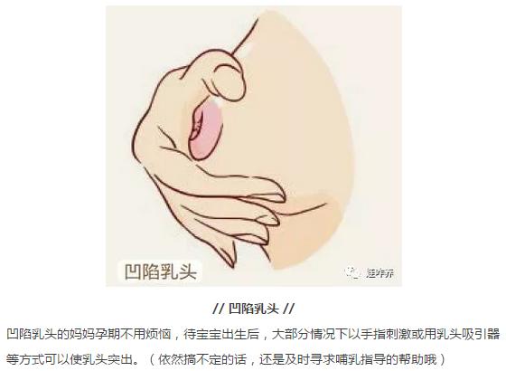 怀孕前兆乳房头图片图片