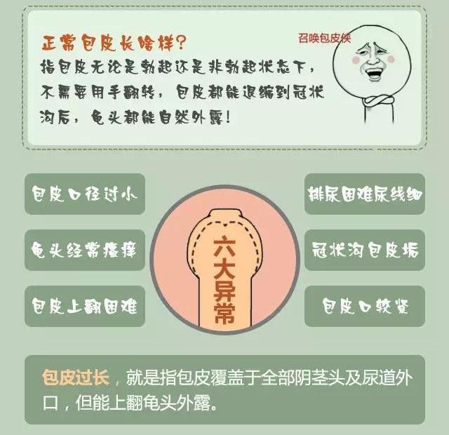 包茎白色污垢怎么处理图片