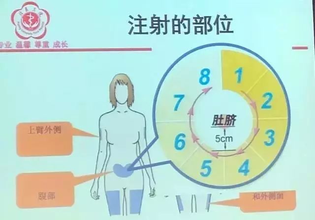 腹部注射肝素钠位置图图片