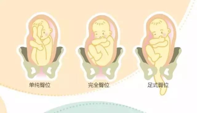 孕31周宝宝正常胎位图图片