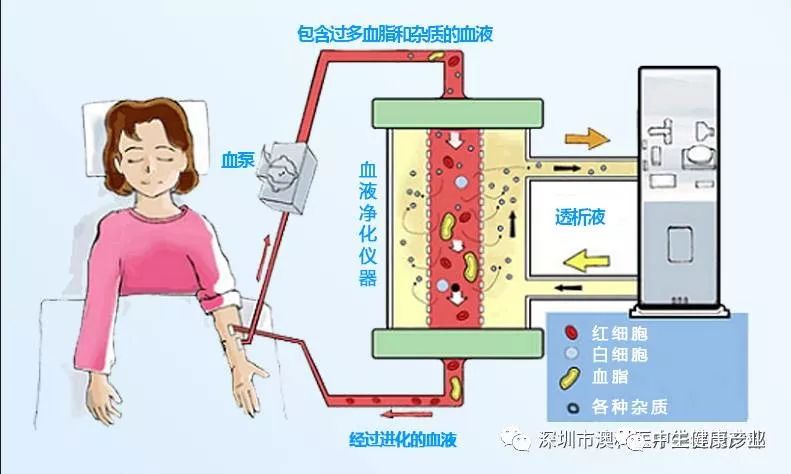 血液净化图片宣传图片