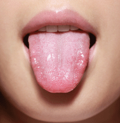 健康人的舌苔正常人图片