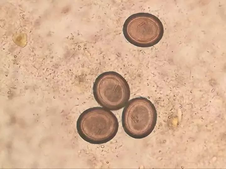 在显微镜下看到的四个典型的绦虫卵,卵内隐约可见六钩蚴有意思的是