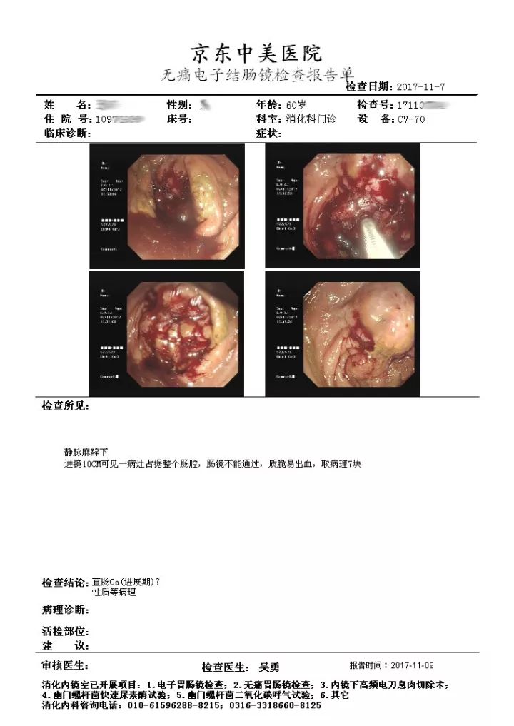 结肠癌晚期图片