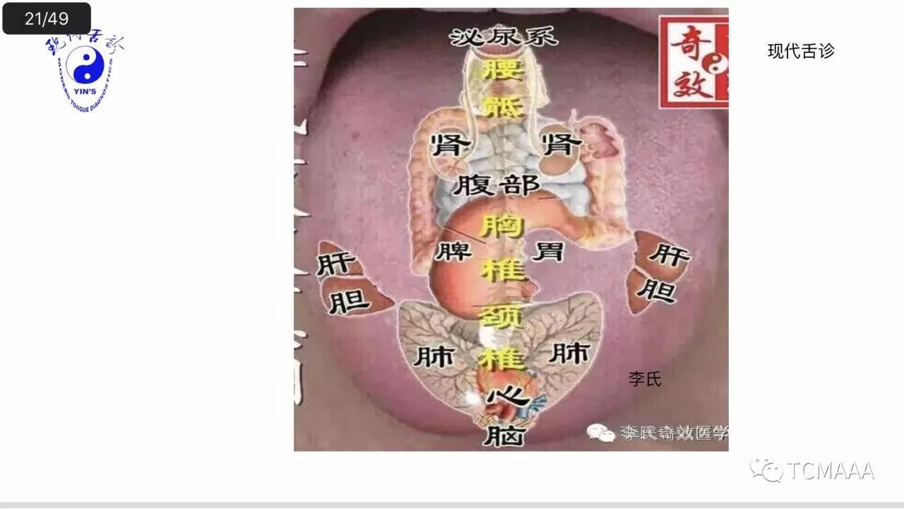 舌诊全息反射区图图片