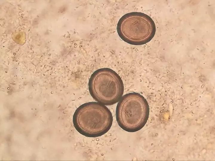 缩小膜壳绦虫卵图片