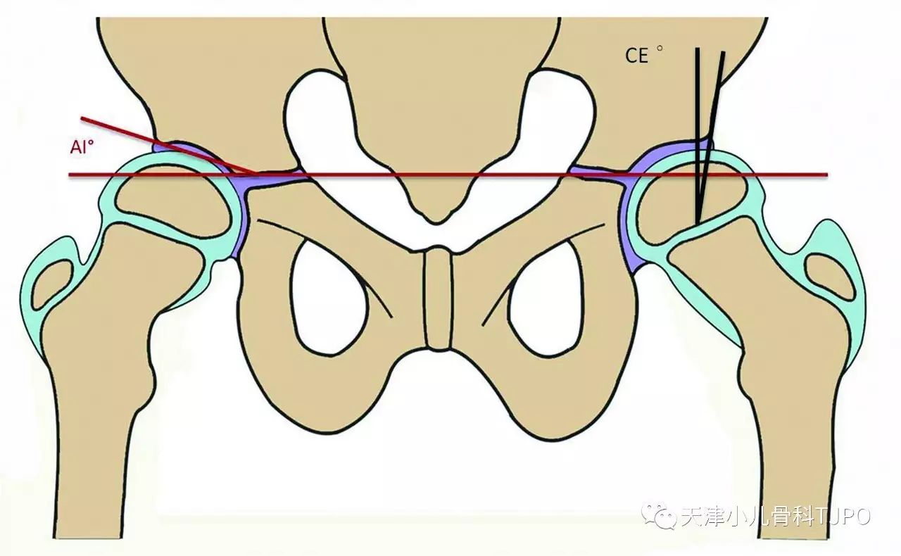 一文掌握 | 髋臼的解剖、生物力学与受伤机制_医学界-助力医生临床决策和职业成长