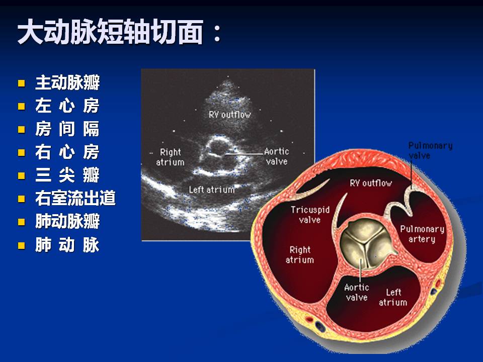 超声心动图基础知识和常用切面