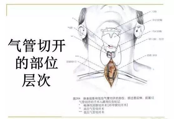 頸部解剖基礎珍藏版