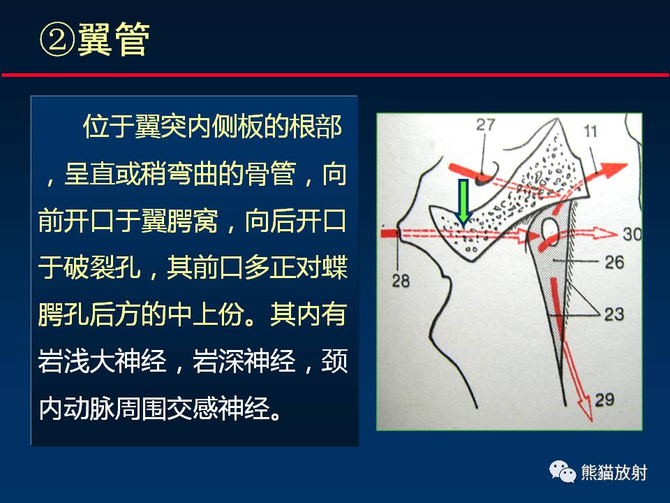 翼管解剖图片