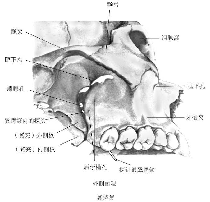 翼下颌韧带解剖位置图图片