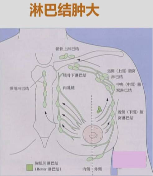 乳腺淋巴分布图片图片