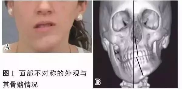 这些小事让孩子越长越丑!家长一定要看,现在改还来得及!