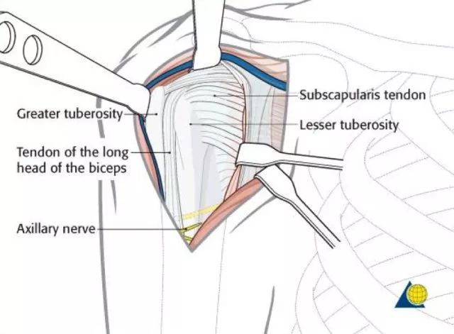 tuberosity图片