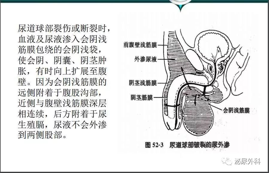 泌尿系损伤