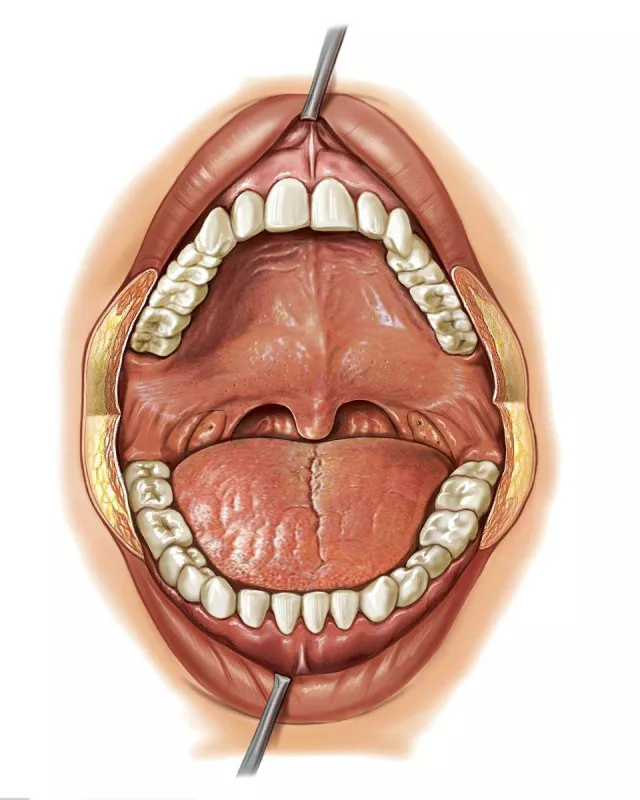 正常人的口腔两侧图片图片