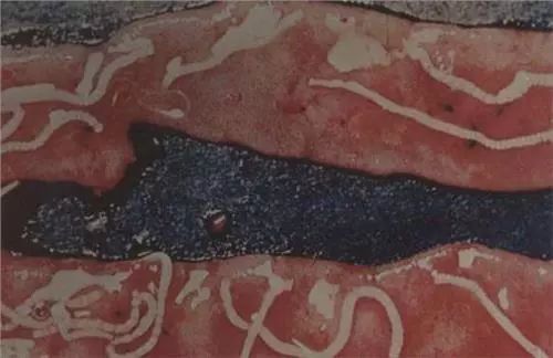 猪肉绦虫病图片