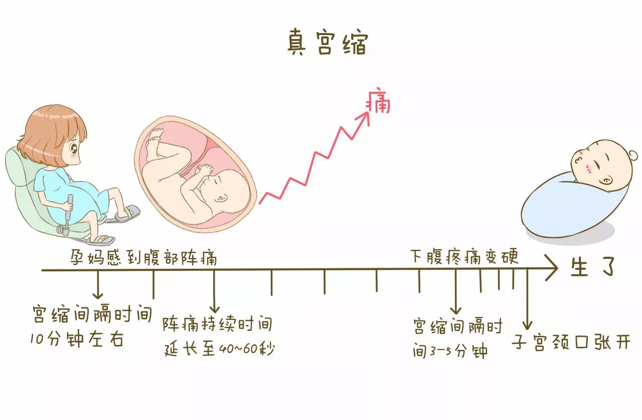 无痛分娩可以刺激宫缩,缩短产程,减少准妈妈们分娩时的恐惧和倦怠感