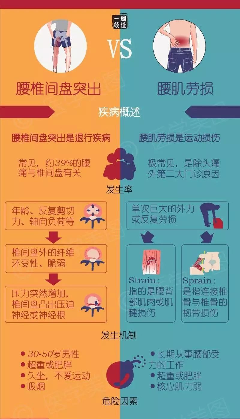 我是不是腰椎间盘突出了?