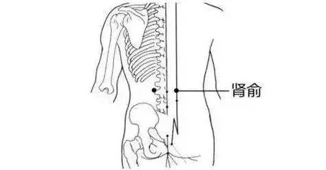 肾纹的准确位置图图片