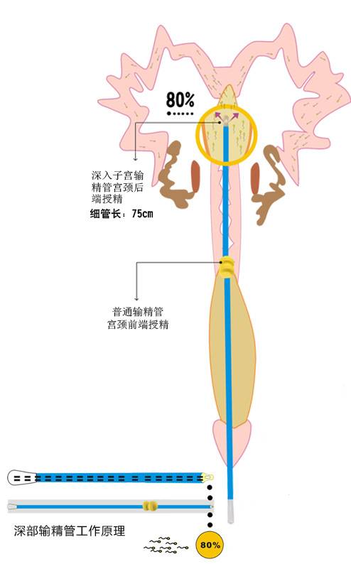 母猪输精大概输多深图片