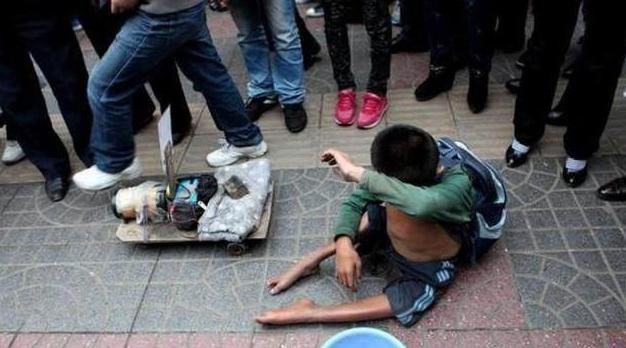 被砍手的小孩乞丐照片图片