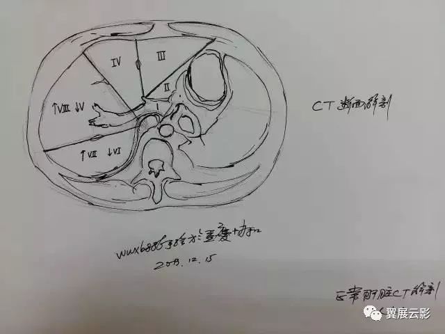 肝素描图片