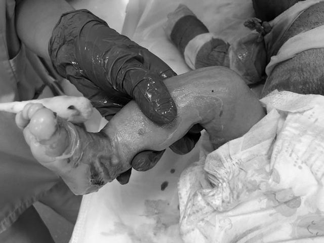 福尔马林泡着的婴儿图片