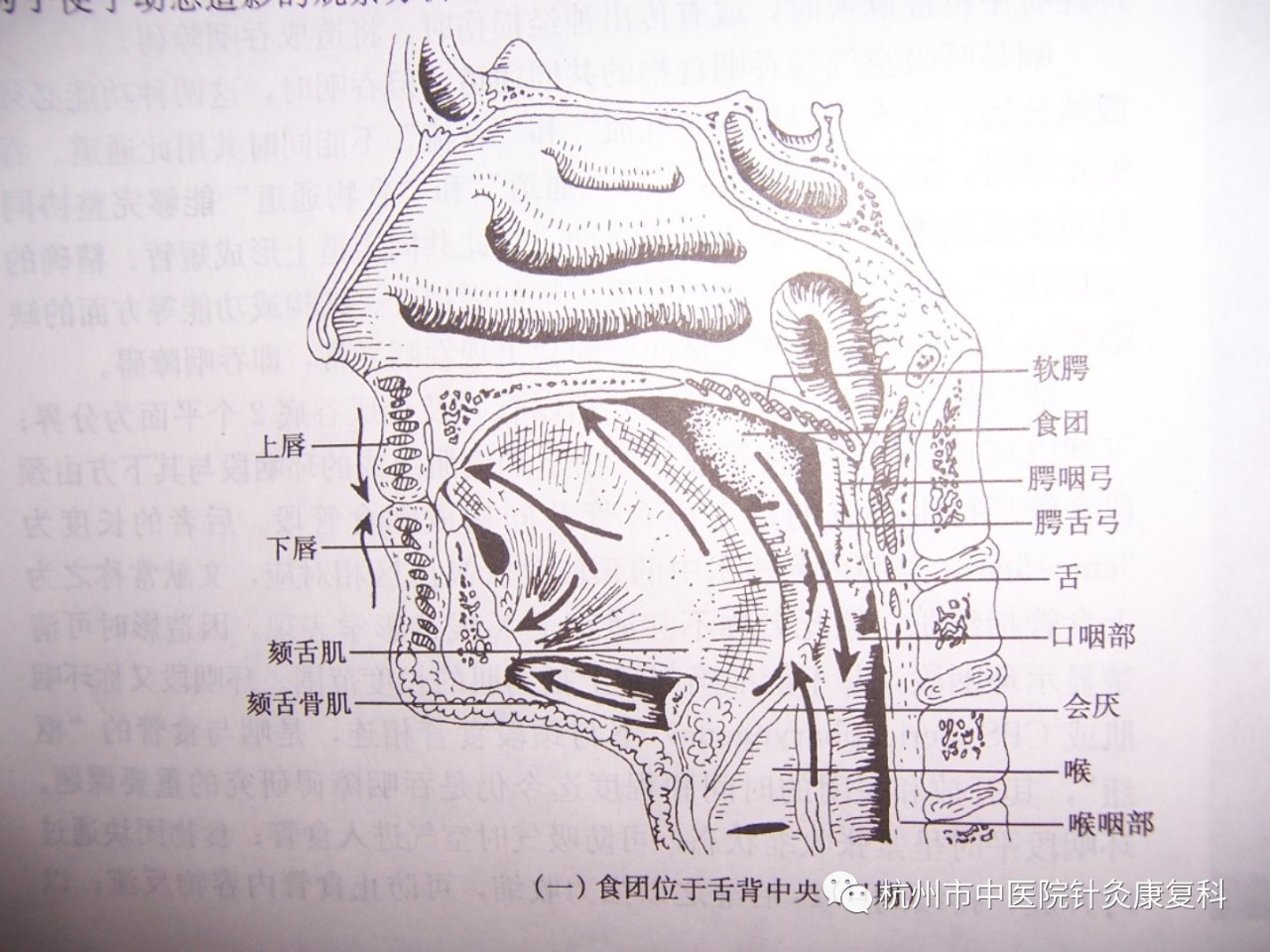 字面理解是本應該順利從口腔,通過食管進入胃部的食物,因為種種原因