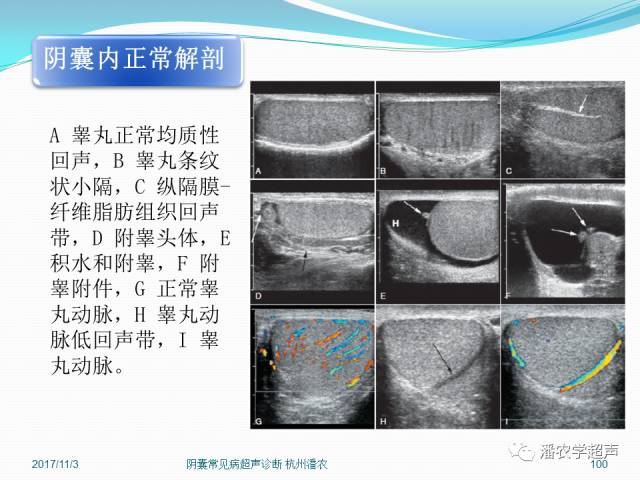 正常睾丸彩超图图片