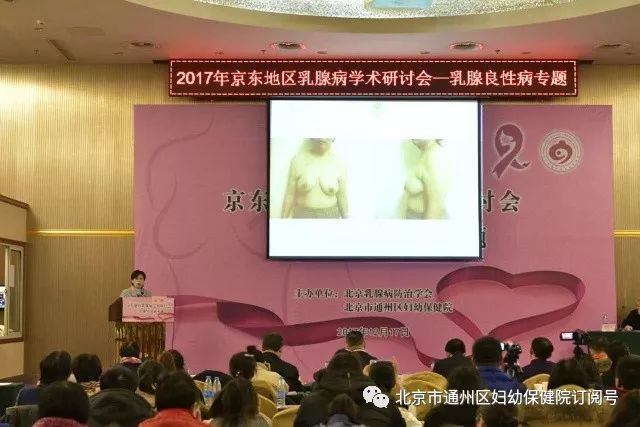 关爱女性健康促进乳腺病防治通州妇幼举办京东地区乳腺病学术研讨会