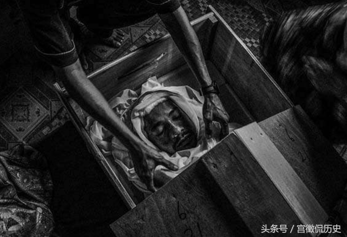 癌症晚期死亡过程图片