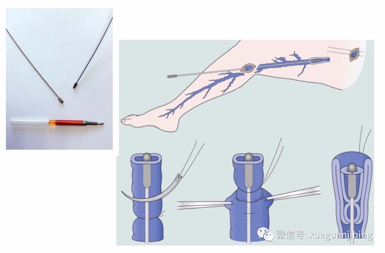 下肢手术消毒范围图解图片