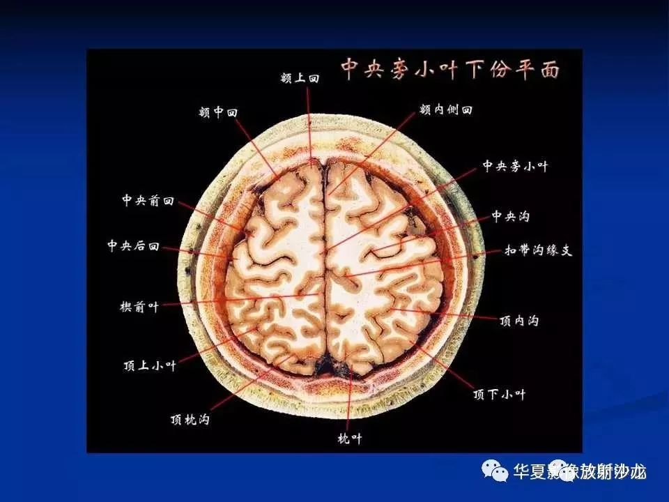 各部位詳細標註的大腦斷層解剖