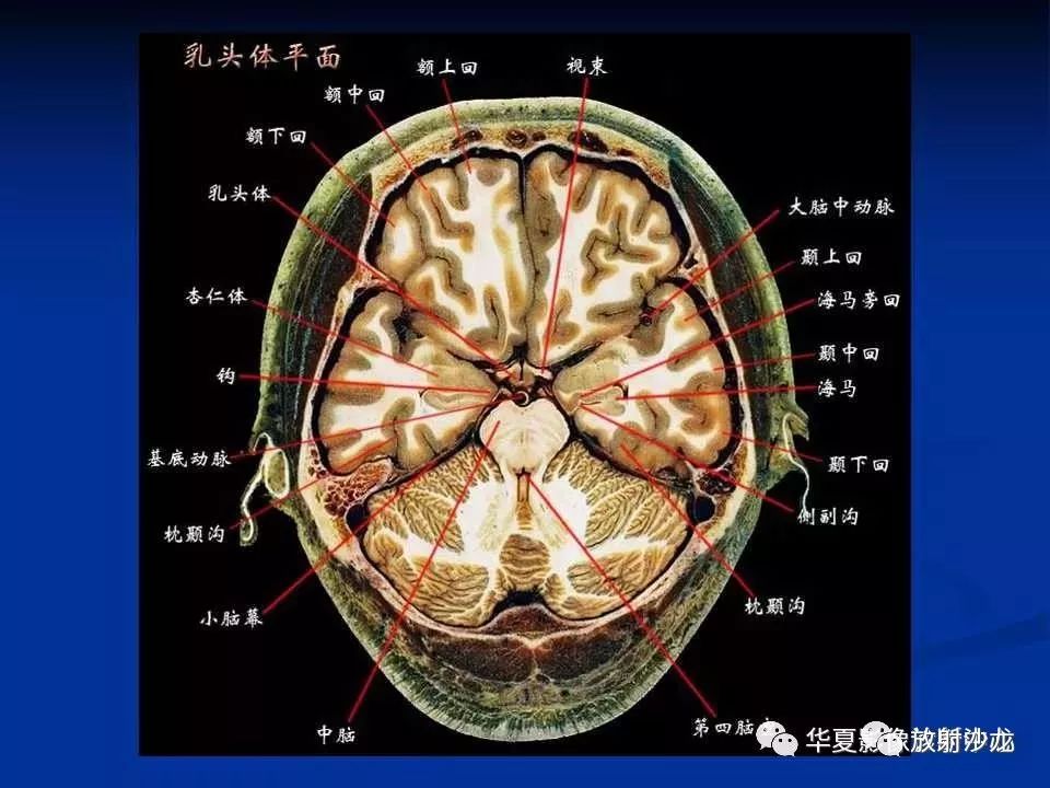 背侧丘脑断层解剖图图片