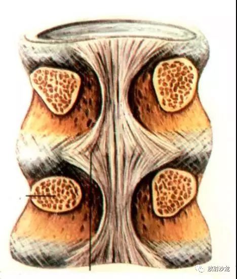 椎管狭窄矢状径图片