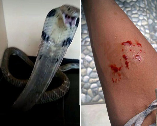 令人唏嘘印尼少年被宠物毒蛇咬伤不治身亡