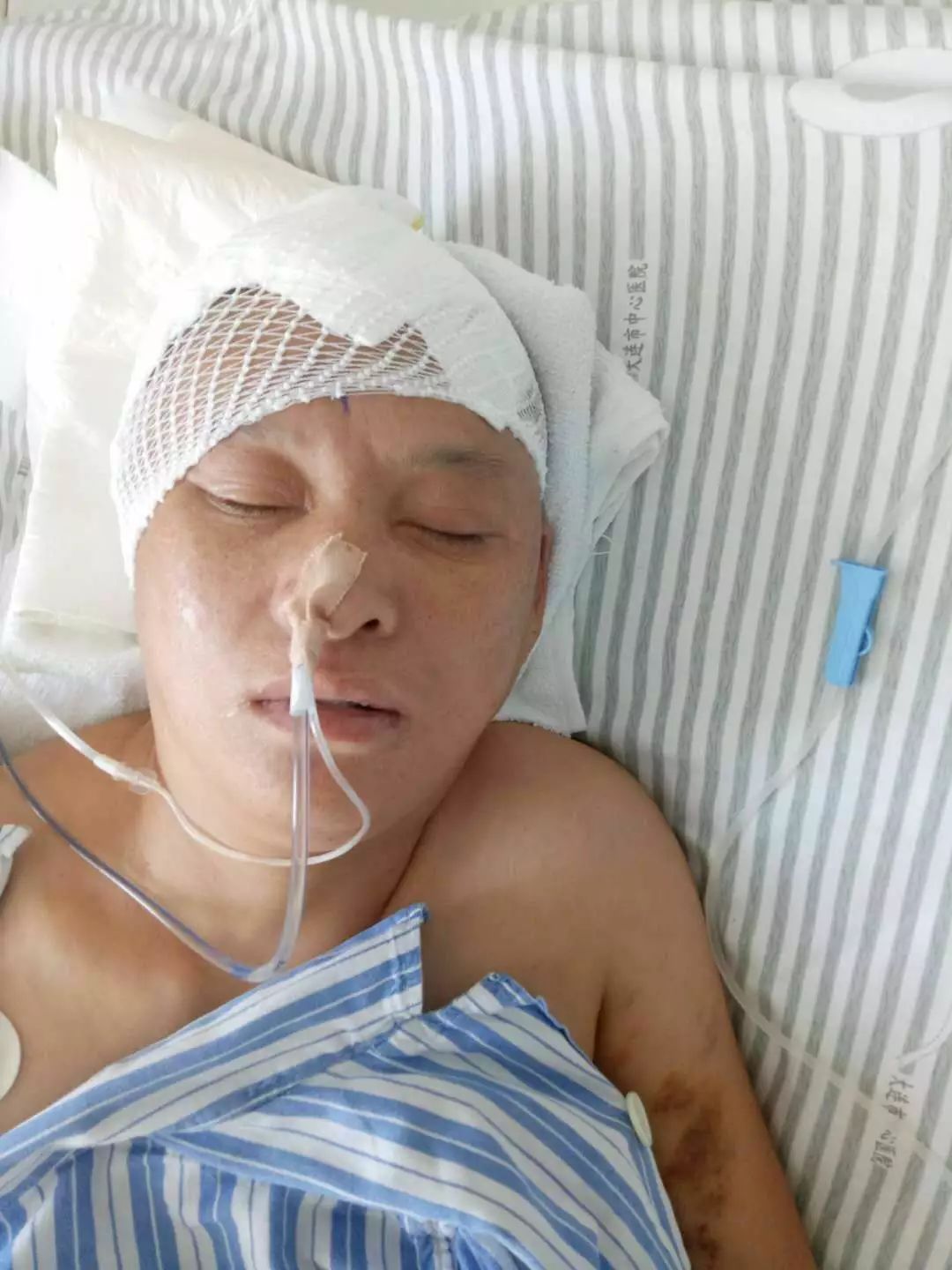 救救年輕45歲腦出血媽媽以見好轉急需幫助